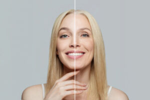 Read more about the article 9 Things You Need To Know About How To Use Retinol For Beginners