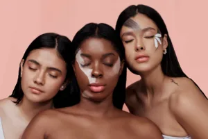 Read more about the article How to Repair a Damaged Skin Barrier & Basic Skincare Routine